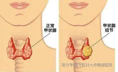 下載 (7).jpg